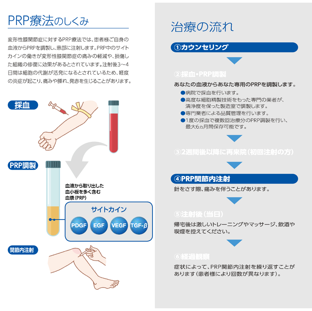 他院との違い（当院PRPの特徴）