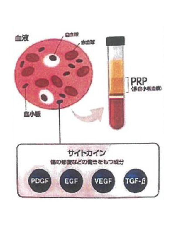 PRPとは